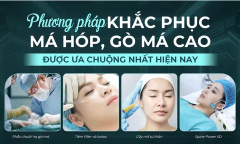 Giải pháp khắc phục má hóp, gò má cao được ưa chuộng nhất hiện nay